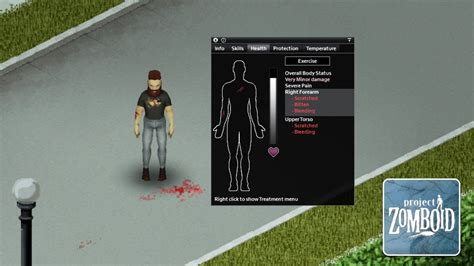 Zomboid Project: Survival Horror Where Every Zombie Bite Can End Your Story!